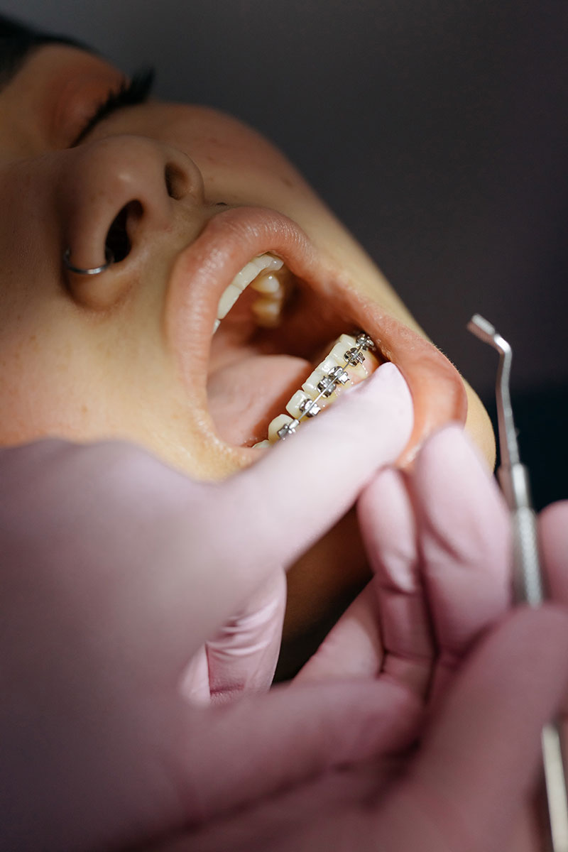 Townsend Orthodontics Adelaide